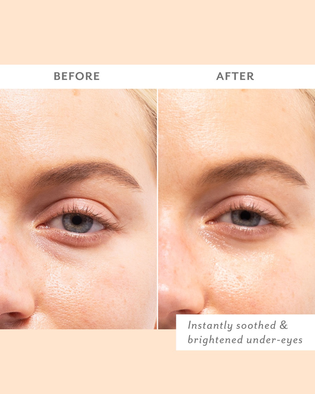 Patchs Contour des Yeux Soin Rénovateur
