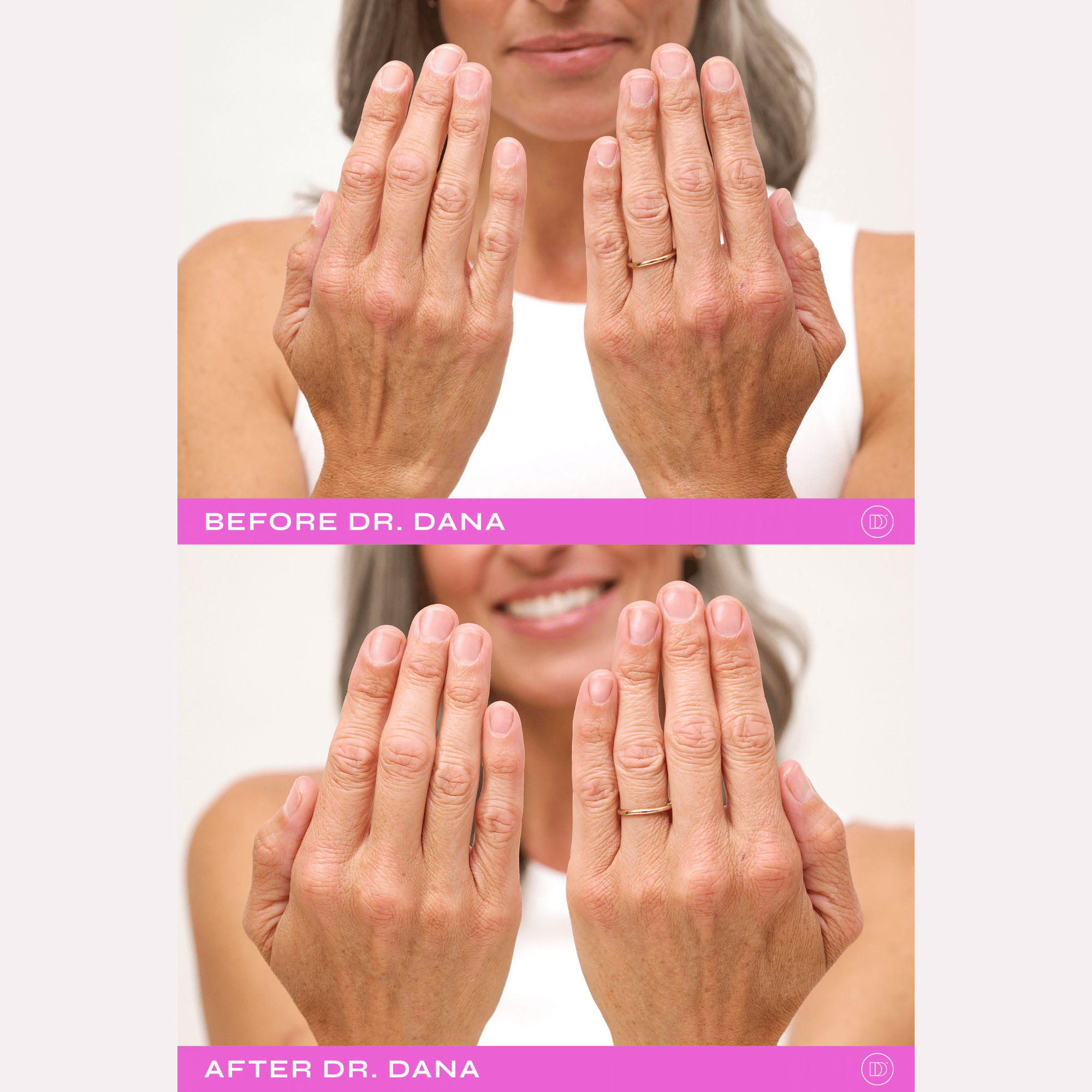 Système de renouvellement des ongles Dr. Dana